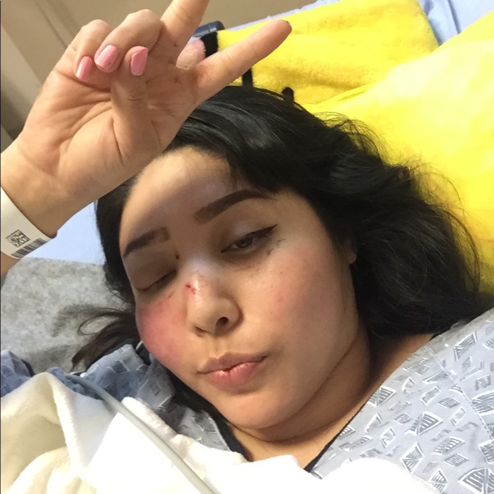 I was hit by a car